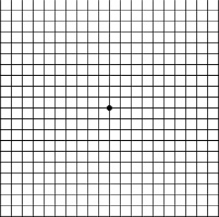 normal ansler grid